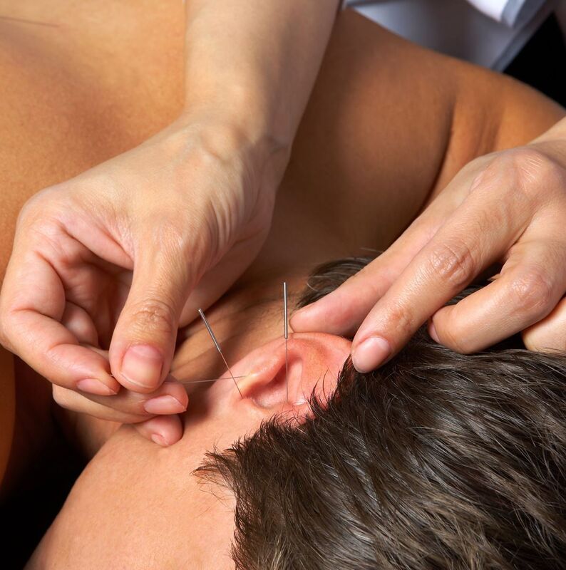 耳に鍼を打つ